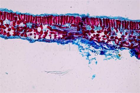 Host Cells With Spores Mold Are Inside Wood Under The Microscope Stock ...