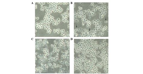 Hypericin-mediated photodynamic therapy induces apoptosis in K562 human ...