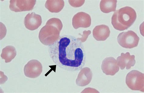 band – Cells and Smears