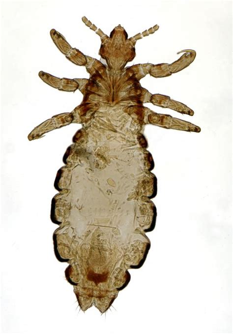 What is the Difference Between Lice and Scabies?