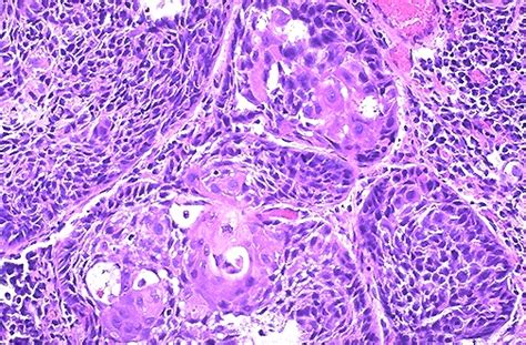 Pulmonary Pathology