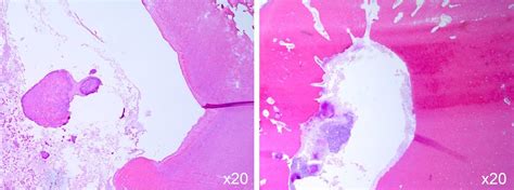 Dentin dysplasia: diagnostic challenges | BMJ Case Reports