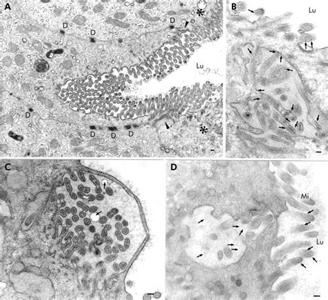 Autophagocytosis of the apical membrane in microvillus inclusion disease | Gut