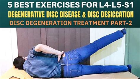 5 Exercises- Lumbar Disc Degeneration, Disc Desiccation, Degenerative ...