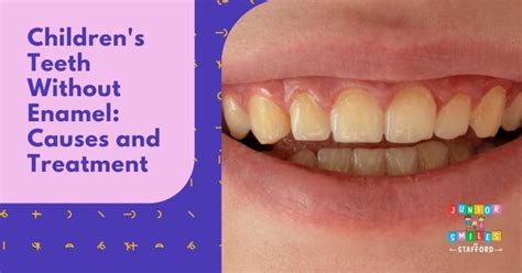 Children's Teeth Without Enamel: Causes and Treatment | Junior Smiles ...