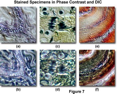 Molecular Expressions Microscopy Primer: Specialized Microscopy Techniques - DIC and Phase ...