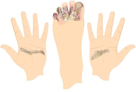 Electrical Injuries - RCEMLearning