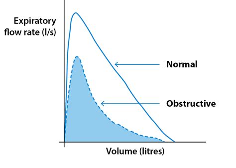 Spirometry and bronchodilator responsiveness testing | Asthma + Lung UK