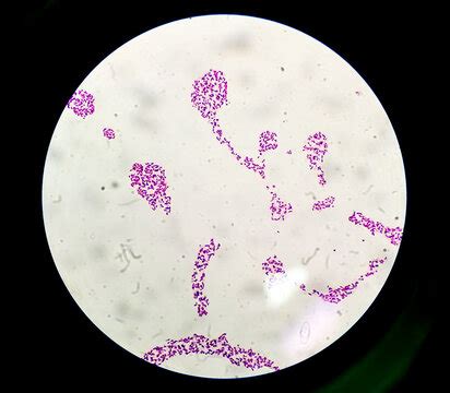 Salmonella Typhi Under A Microscope