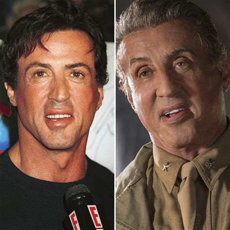 Sylvester Stallone's Plastic Surgery Is Weighed in on by Experts