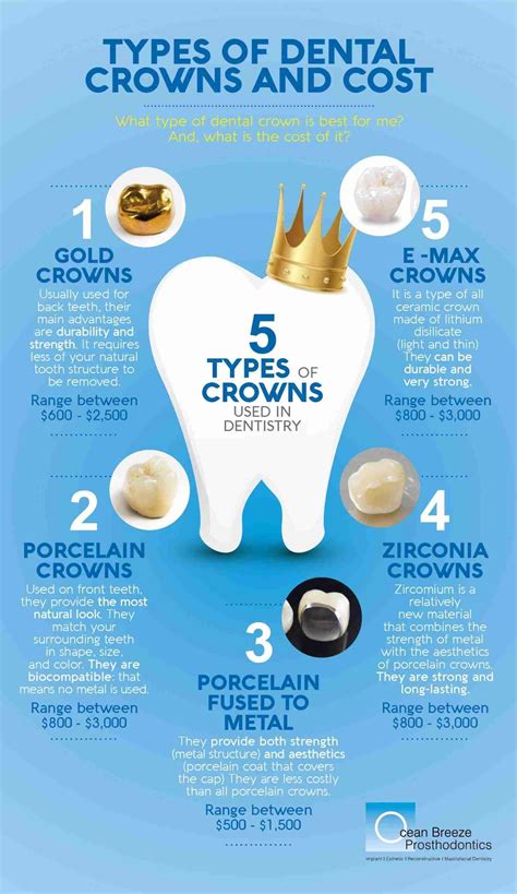 TYPES OF DENTAL CROWNS AND COST: A COMPLETE GUIDE (2021)