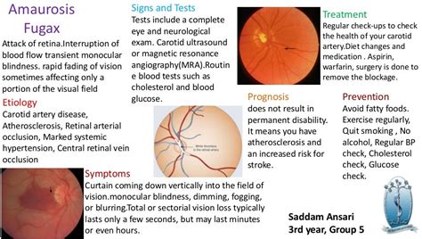 Amaurosis fugax