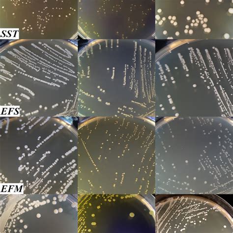 Streptococcus Salivarius Morphology