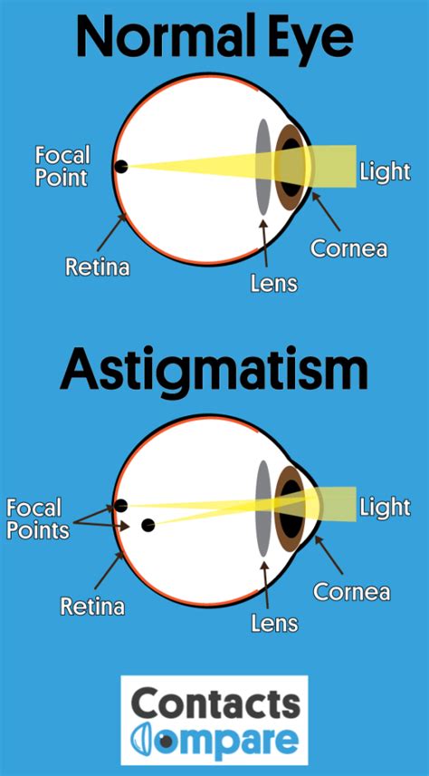 What is Presbyopia – Symptoms, Treatments and Causes