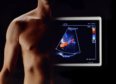 Musculoskeletal Ultrasound – TrueScan Radiology