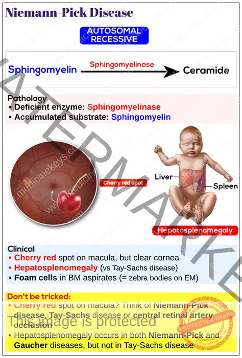 Niemann-Pick disease - Medicine Keys for MRCPs