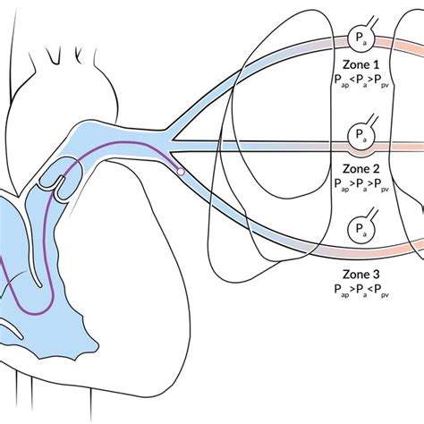 (PDF) The contemporary pulmonary artery catheter. Part 1: placement and ...