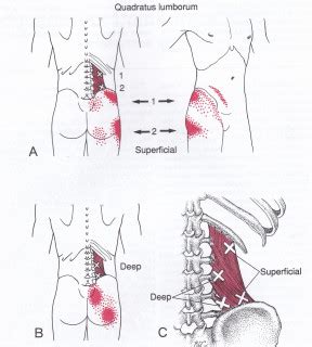 The easy way to release trigger points in your low back | Dr Graeme Massagers