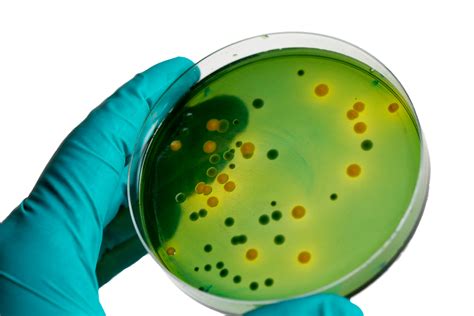 Urine culture | Pathology Tests Explained