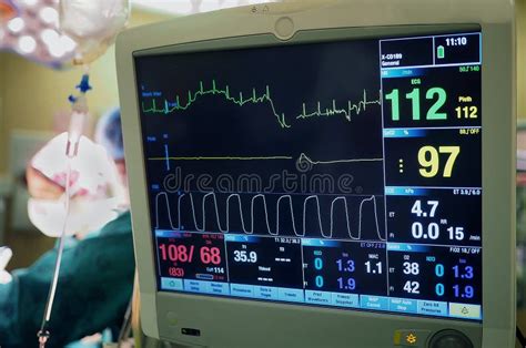 Hospital Ecg Machine