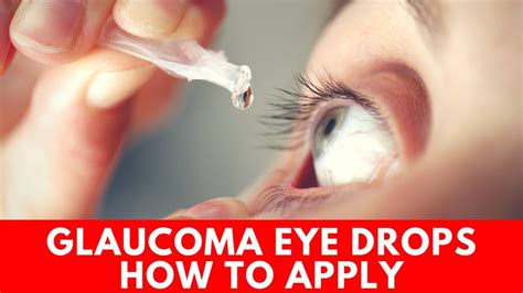 Glaucoma Eye Drops Chart