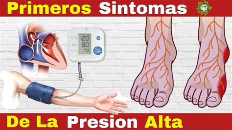 Sintomas De Presion Alta Hipertension Arterial Youtube – Bilarasa