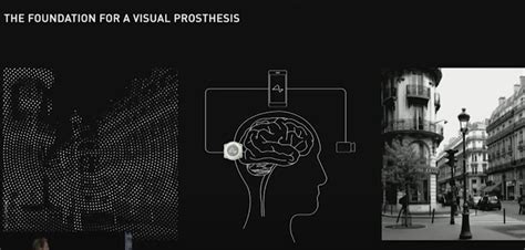 Neuralink Day Highlights a Brain Implant With Over 4000 Channels ...