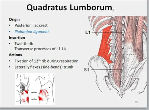 QL muscle release - Exercise for low back pain - Physio Prescription