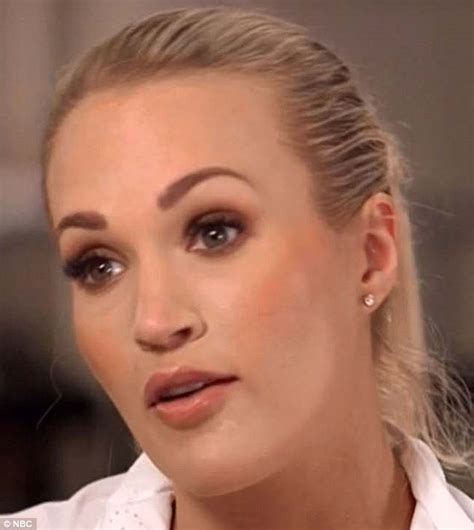 Carrie Underwood shows scars in first TV interview since accident ...