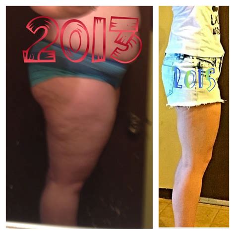 Leg photos before and after — MyFitnessPal.com