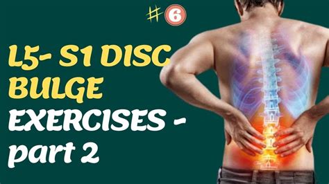 L5 S1 Disc bulge exercises | Degenerative disc disease | Sciatica ...