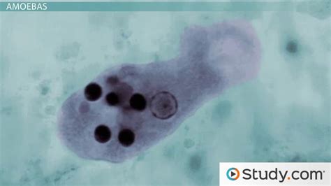 What are Protozoa? - Definition, Characteristics & Examples - Video & Lesson Transcript | Study.com