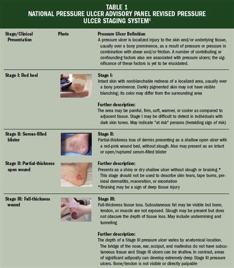 Pressure Ulcer Staging Guide