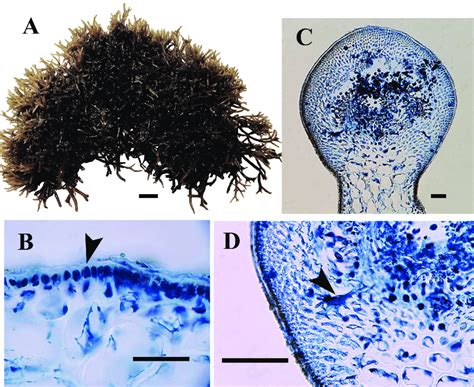 Gracilaria chondracantha: A. habit; B. transverse section of cortex... | Download Scientific Diagram