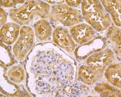 DLL4 Antibody (NBP2-89151): Novus Biologicals