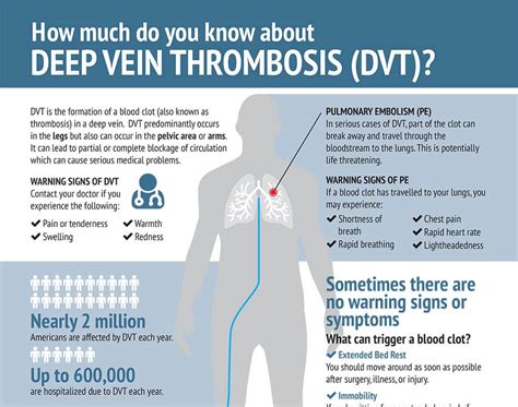 Deep Vein Thrombosis DVT - Indiana Vein Specialists