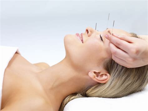 Acupuncture for Headaches and Migraines - Back to Health