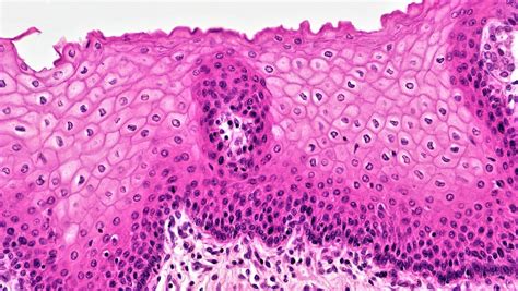 Epithelial Tissues: Stratified Squamous Epithelium | Flickr
