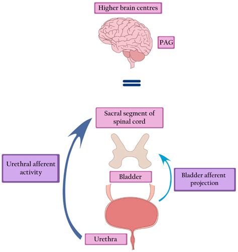 IJERPH | Free Full-Text | Fowler’s Syndrome—The Cause of Urinary Retention in Young Women, Often ...