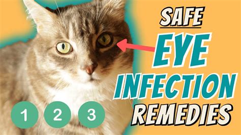 Eye Infection Home Remedies - YouTube