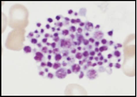 Platelet morphology