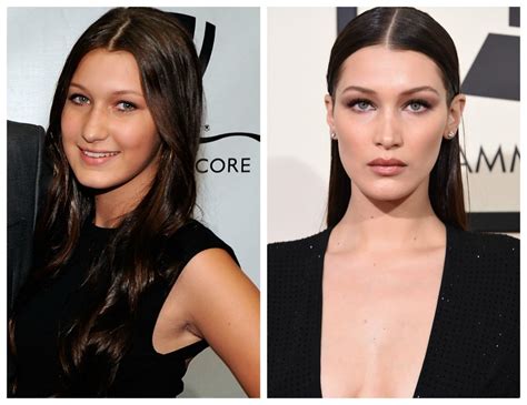 Did Bella Hadid Get a Nose Job? See Before and After Photos of the Model's Alleged Plastic Surgery!