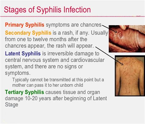 Syphilis Symptoms In Men / Sign and Symptoms of syphilis in Men and ...