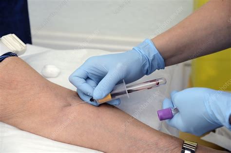 Blood sampling - Stock Image - C015/1678 - Science Photo Library