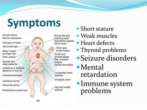 PPT - Down Syndrome PowerPoint Presentation, free download - ID:5944198