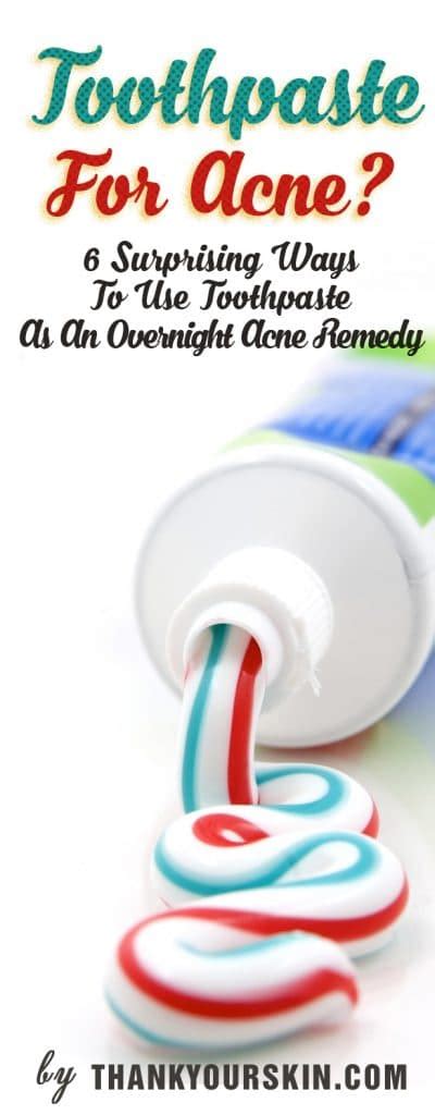 Toothpaste For Acne? 6 Surprising Ways To Use Toothpaste As An ...