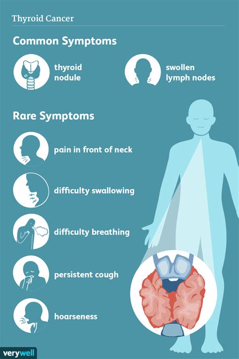 Thyroid Cancer: Signs, Symptoms, and Complications