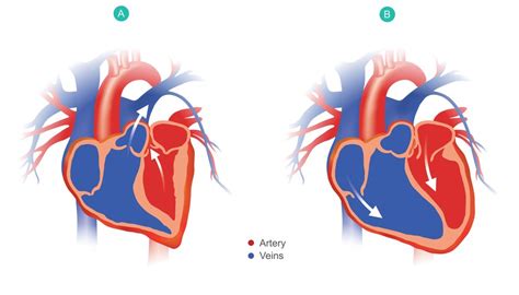 What Are The Functions Of The Left And Right Atria Sciencing | Free ...