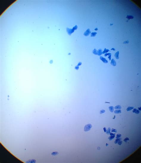 My cheek cells 100x magnification | Landmarks, Northern lights, Natural landmarks