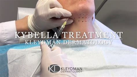 Kybella Grid Template